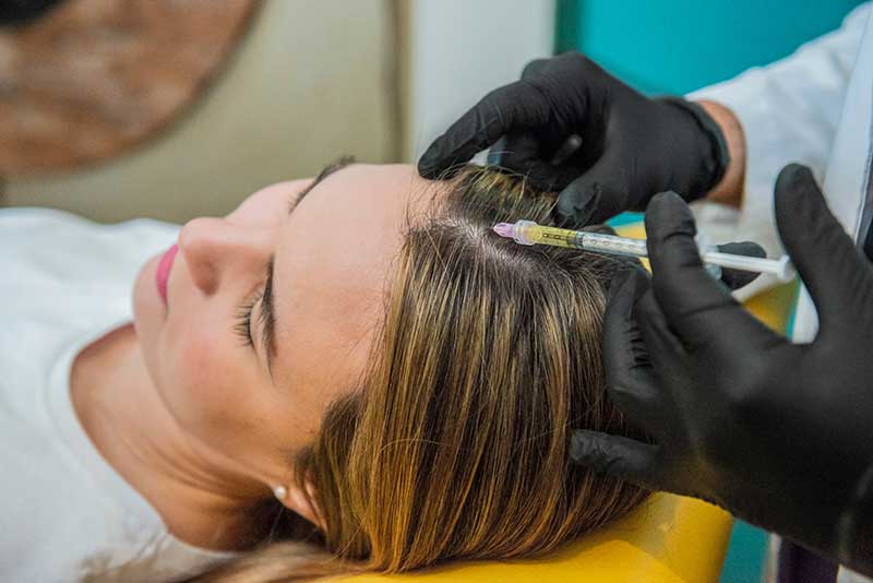 Platelet-Rich Plasma PRP Scalp Injections